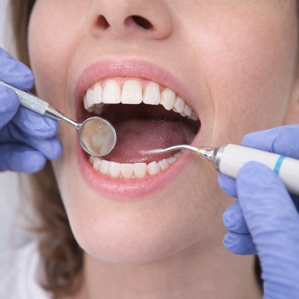 Genel Diş Muayenesi ve Koruyucu Tedaviler